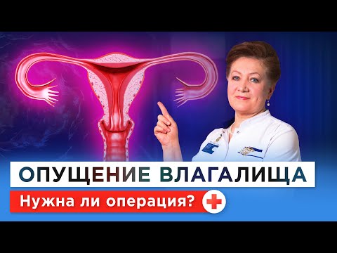 Видео: Что делать при опущении матки и влагалища? Симптомы, упражнения, бесплатное лечение и по ОМС