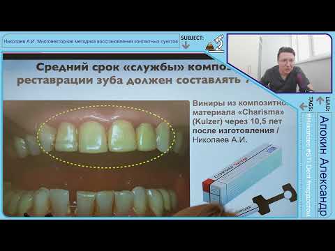 Видео: Николаев А.И. Эстетическая реставраця фронтальных, жевательных зубов #STIDENT #ПЕРДОСТОМ -Часть 2 4K