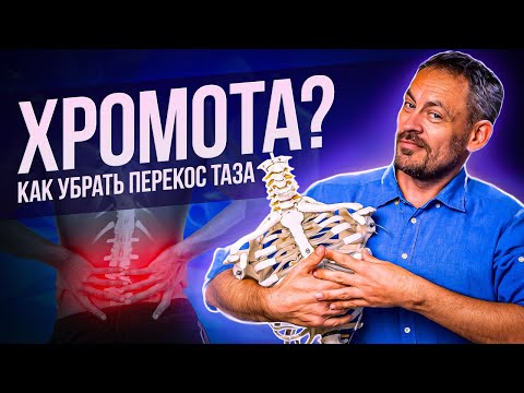 Видео: Перекос таза - как исправить за 15 мин