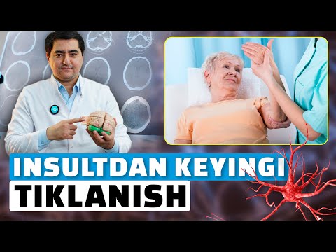 Видео: ИНСУЛЬТДАН КЕЙИНГИ ЭНГ САМАРАЛИ ТИКЛАШИН УСУЛЛАРИ