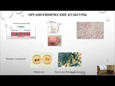 Видео: In vivo/in vitro тестирование химиотерапии при анапластическом раке щитовидной железы