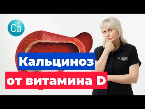 Видео: Кальциноз от витамина Д? Доктор Лисенкова