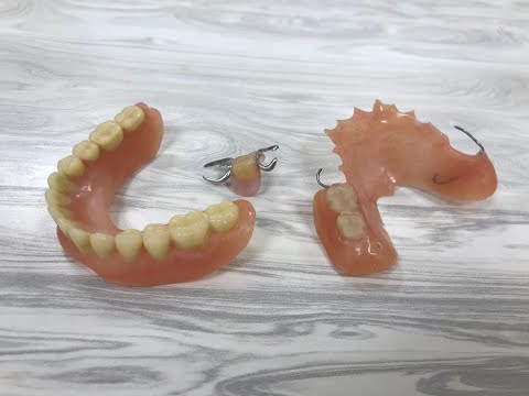 Видео: Съёмные протезы - гигиена и уход