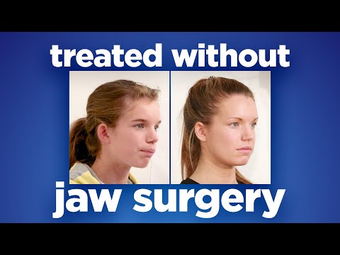 Видео: Преображение Николы: преодоление сильного перекуса естественным путем