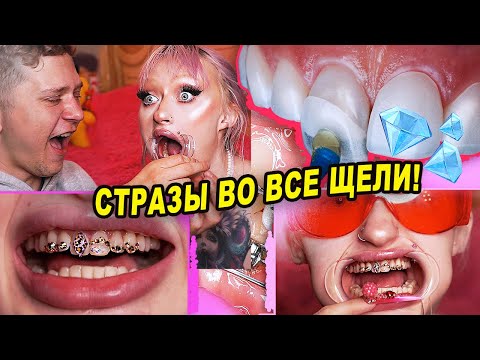 Видео: СТРАЗЫ НА ЗУБЫ ДОМА ( СКАЙСЫ) ПРИВЕТ, КАРИЕС! ЗУБКИ ТО ГНИЮТ...