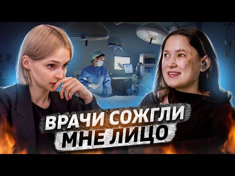 Видео: Прижгли лицо жидким азотом | потеряла зрение и красоту