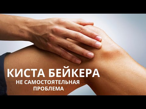 Видео: Киста Бейкера - избавляемся от неё и предупреждаем разрушение сустава.