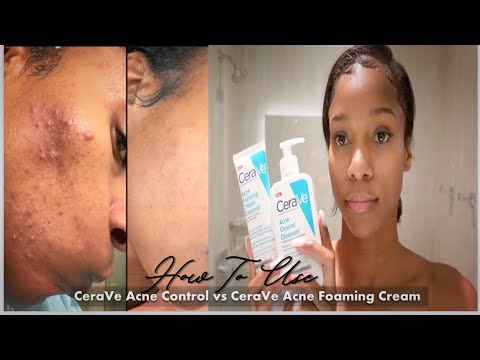 Видео: Как использовать✨ CeraVe Acne Control Cleanser против CeraVe Acne Foaming Cream Cleanser 🙌🏾 30-дн...