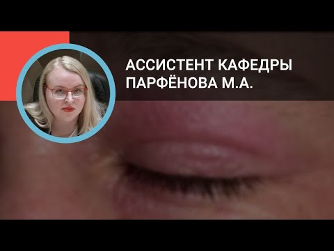 Видео: Парфёнова М.А.: Атопический дерматит
