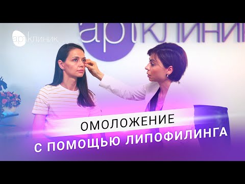Видео: Омоложение на годы. Пересадка собственного жира. Безопасно и БЕЗ АЛЛЕРГИИ | АРТ-Клиник