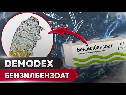 Видео: Бензилбензоат против клеща | Угревая Железница Demodex