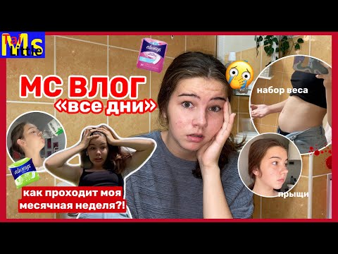 Видео: MC VLOG || все дни || ПРЫЩИ ЖИВОТ ПЕРЕПАДЫ НАСТРОЕНИЯ