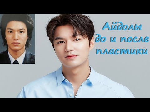 Видео: Айдолы до и после пластики / айдолы сделавшие пластику
