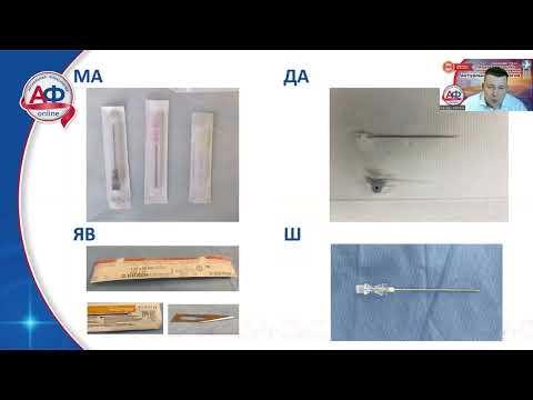 Видео: Минифлебэктомия  Конспект  18 минут