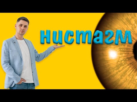 Видео: Нистагм причины и лечение