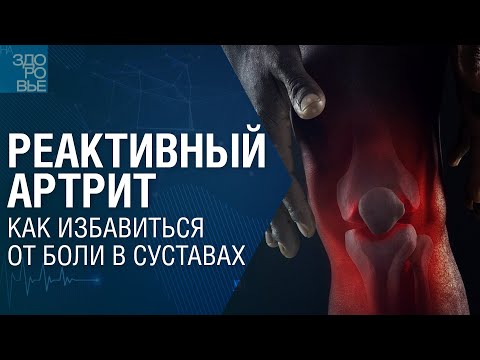 Видео: Реактивный артрит. Как избавиться от боли в суставах. На здоровье 14.01.2023