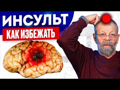 Видео: Всего 1 точка предупредит инсульт