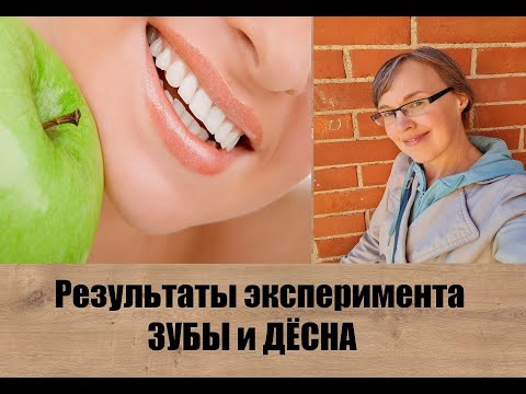 Видео: Зубы и дёсна - результаты эксперимента