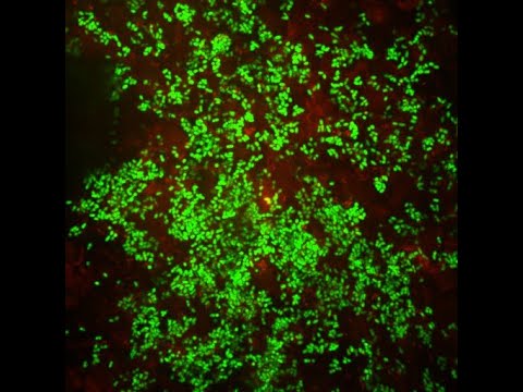 Видео: 7. Хреми. Синуити. Бактериални биофилми