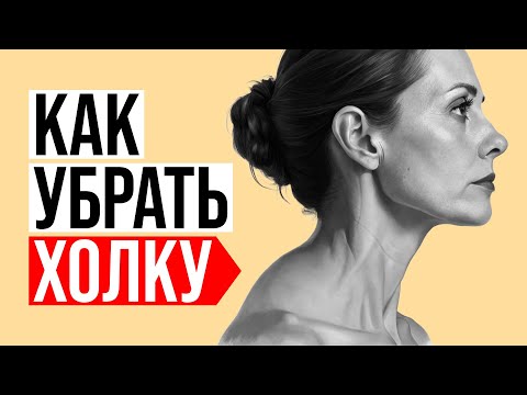 Видео: Холка или "Вдовий горбик". Как убрать? Причины. Почему гимнастика  шеи и массажи не помогают?