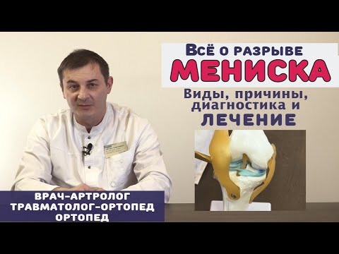 Видео: Разрыв мениска - симптомы, причины и лечение разрыва мениска. Травмы и повреждения мениска колена.