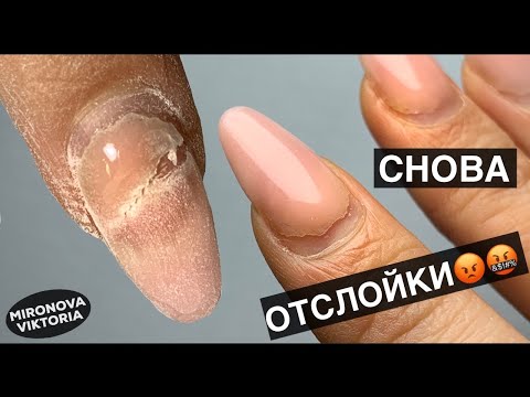 Видео: Как мне надоели эти отслойки. Мастер класс Коррекции себе на правой руке.