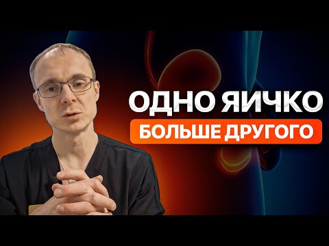 Видео: Одно яичко больше другого. Врач уролог-андролог. Москва.