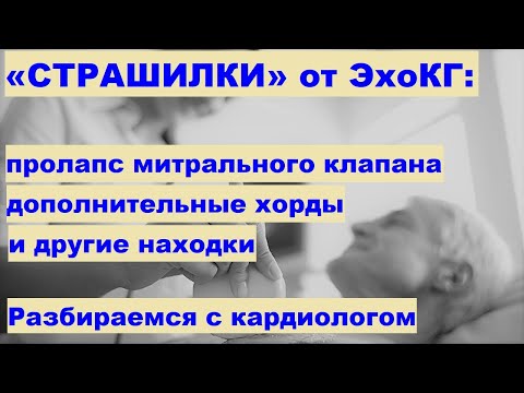 Видео: Типтева Т.А. «Страшилки» от ЭхоКГ: пролапс митрального клапана, дополнительные хорды и другое