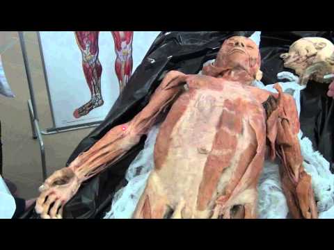 Видео: Мышцы верхней конечности на трупе