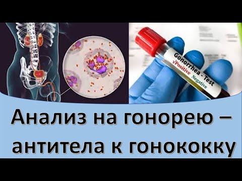 Видео: Анализ на гонорею - антитела к гонококку