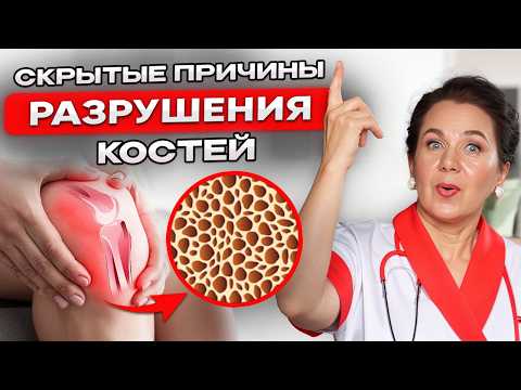 Видео: ОСТЕОПОРОЗ: Как не рассыпаться после 45 лет? Причины, симптомы и методы укрепления костей