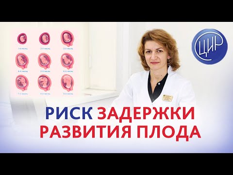 Видео: Повышенный риск задержки роста и развития плода по 1 скринингу. Как снизить выявленные риски?