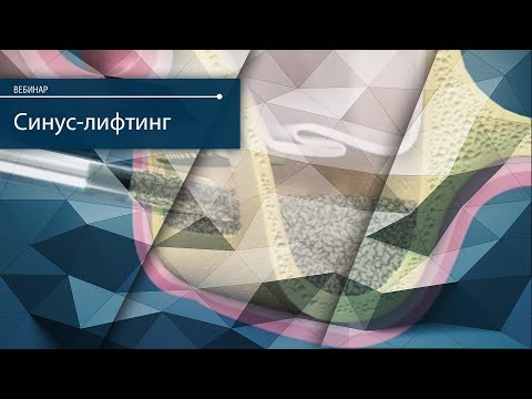 Видео: Методики проведения синус-лифтинга