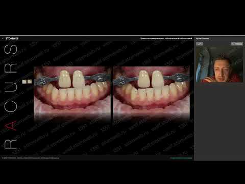 Видео: Артём Олексик - грамотная коммуникация с зуботехнической лабораторией.