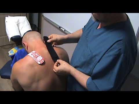 Видео: Кинезиотейпирование трапеции бодибилдера Виталия. Саунапосиделки. Виктор Преподобный