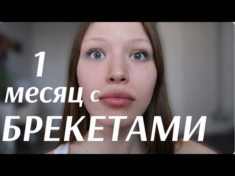 Видео: МЕСЯЦ С БРЕКЕТАМИ/ главные изменения, что я поняла?