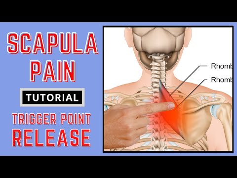 Видео: Учебное пособие по боли в лопатке