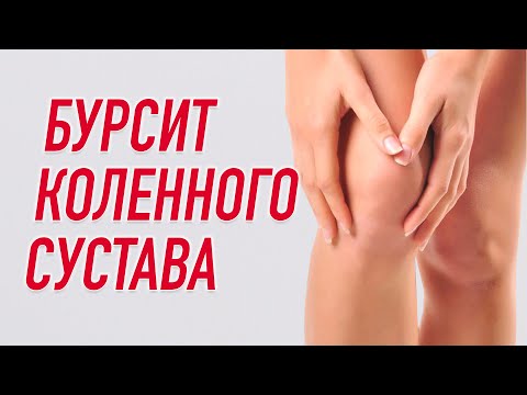 Видео: ▶️ ТЕЙПИРОВАНИЕ ПРИ БУРСИТЕ КОЛЕННОГО СУСТАВА | Валентин Гайт | Учебный центр  BBALANCE