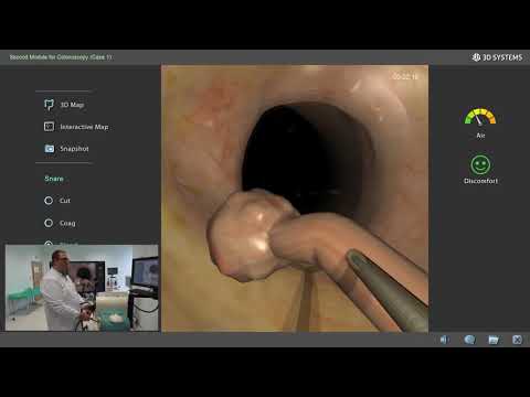 Видео: д-р Никола Боянов, тънкостите на ендоскопската полипектомия на дебело черво