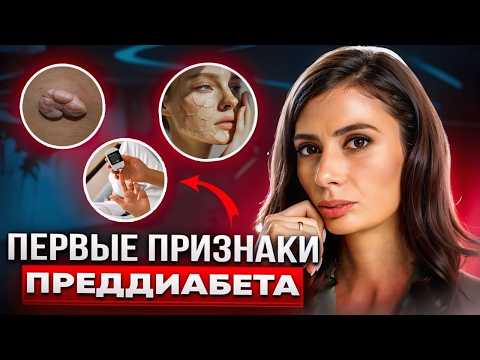 Видео: Не пропусти ЭТИ признаки ПРЕДДИАБЕТА | 4 проблемы кожи, указывающие на САХАРНЫЙ ДИАБЕТ