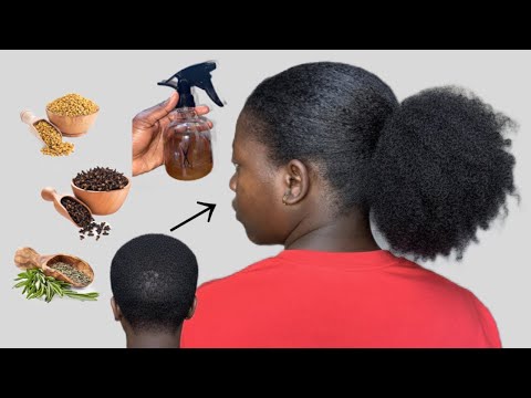 Видео: НЕ СМЫВАТЬ!! ДЕЙСТВУЕТ БЫСТРО😳😳!!! ИСПОЛЬЗУЙТЕ 3 РАЗА В НЕДЕЛЮ/СПРЕЙ ДЛЯ БЫСТРОГО РОСТА ВОЛОС.