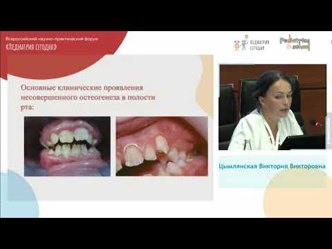 Видео: Несовершенный остеогенез в стоматологической практике