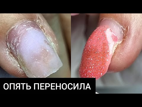 Видео: опять ПЕРЕНОСИЛА