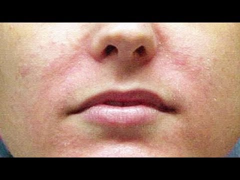 Видео: Омолаживающая маска для очень сухой, дряблой, морщинистой кожи.