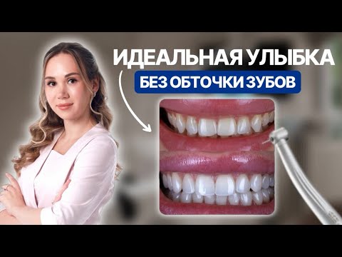 Видео: Идеальная улыбка БЕЗ ОБТОЧКИ зубов.Виниры без обточки существуют #стоматолог#виниры#винирыбезобточки