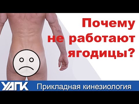 Видео: К чему приводит гипотонус ягодиц? (Кирдогло Г.К.)