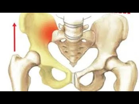 Видео: Упражнения для стабилизации крестцово-подвздошного сустава. Малиновская