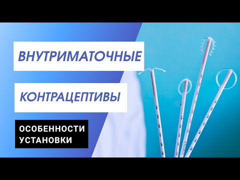 Видео: Введение внутриматочных контрацептивов: мастер-класс