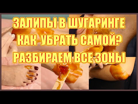 Видео: Залипы при шугаринге. Как убрать самостоятельно. Разбираем все зоны.
