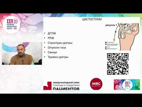 Видео: Уростомы